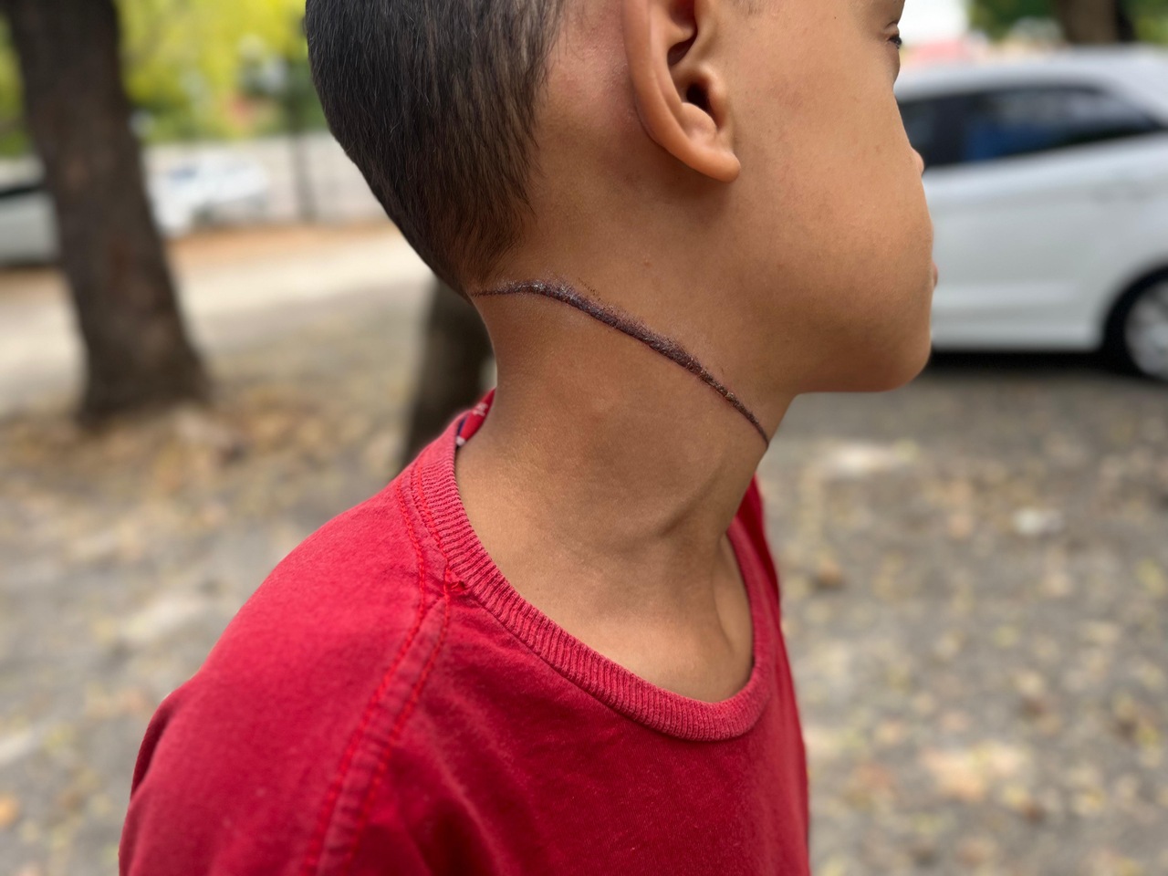 AO VIVO: criança fica ferida por causa de fiação de telefonia solta numa rua de Juazeiro do Norte