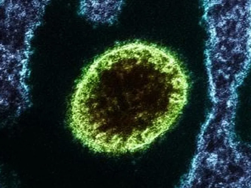 OMS afirma que risco de propagação do vírus Nipah é baixo na Índia