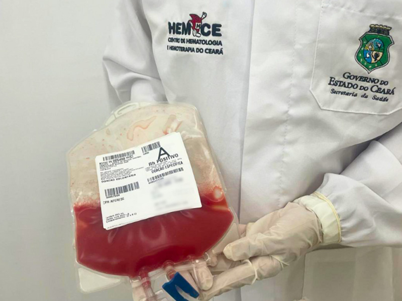 Hemoce integra marco histórico de mil transplantes de medula óssea realizados pelo SUS no Ceará
