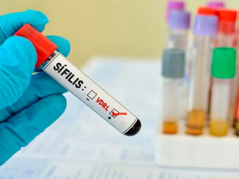 SUS vai oferecer antibiótico para prevenir sífilis e clamídia após exposição