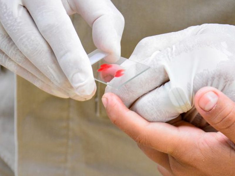 Brasil inicia tratamento inédito contra malária em crianças pelo SUS