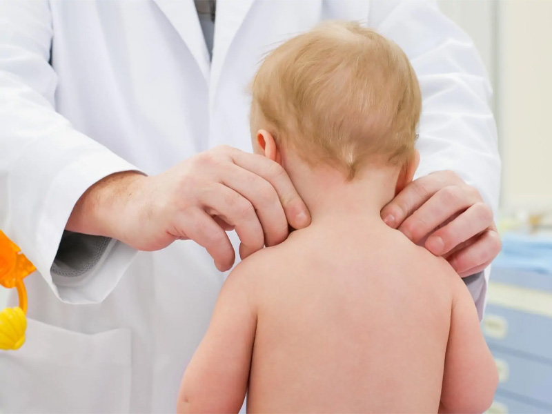 Uece inicia tratamento inédito para crianças com Síndrome de Rett