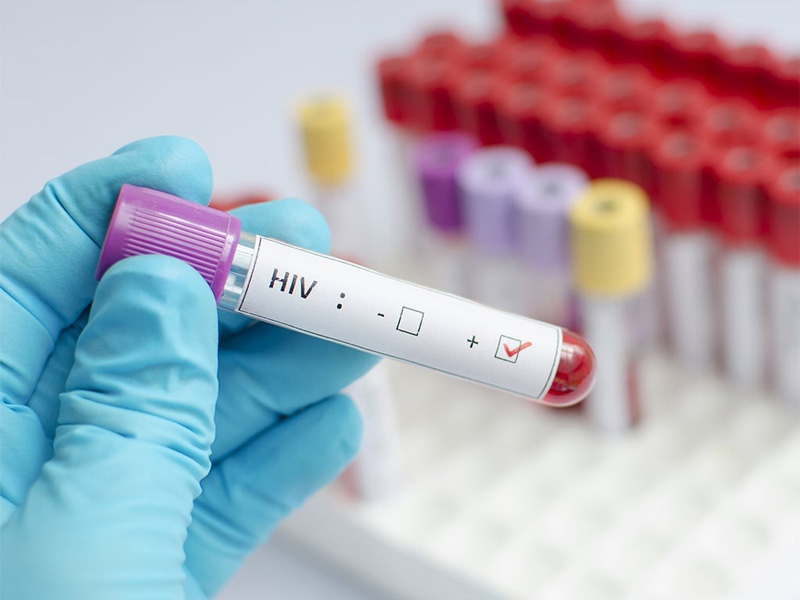 Estudo da Fiocruz testa estratégia inédita para ampliar prevenção do HIV entre jovens