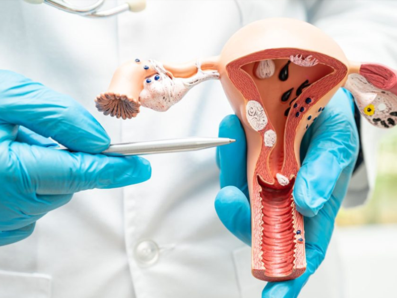CNPq abre edital de R$ 60 milhões para pesquisas sobre endometriose e saúde menstrual